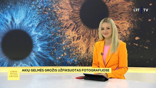 Fotoaparatu fiksuoja akies obuolio rainelę, o pagaminti paveikslai primena kraterius, žvaigždynus